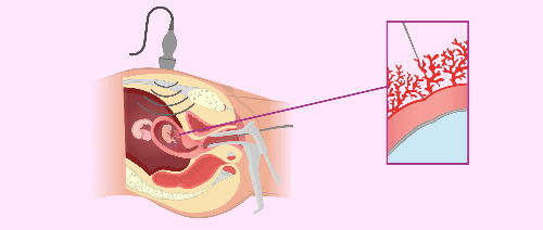 최다음절부터 시작하는 영단어 - 9+@음절 1탄(chorionic-~differ-)